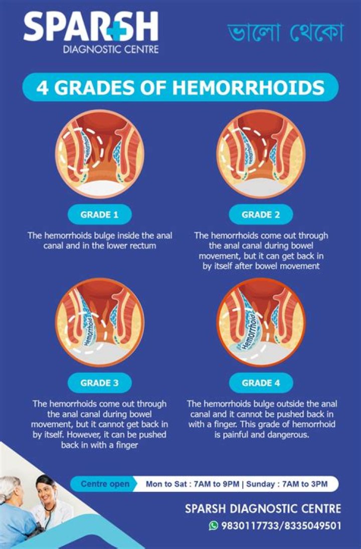 Can a 20 year old have hemorrhoids?