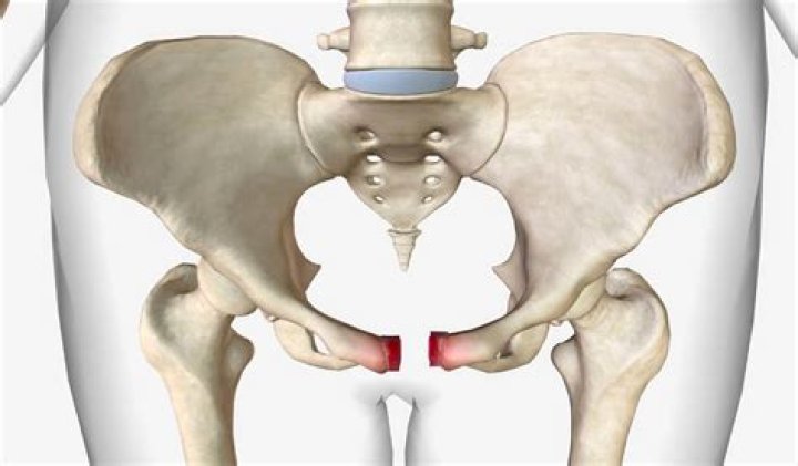 Can a fractured pelvis heal itself?