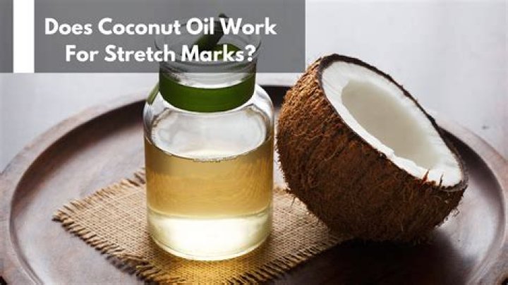 Can coconut oil remove stretchmarks?