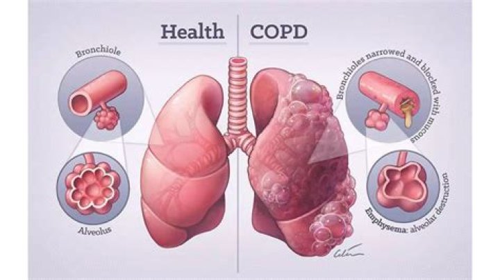 Can COPD affect the ears?