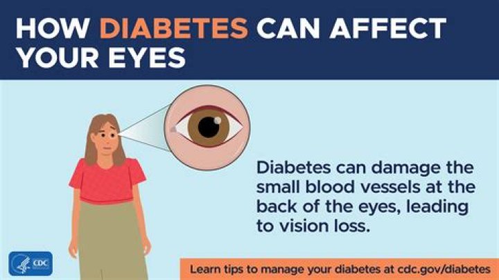 Can COPD affect your eyes?