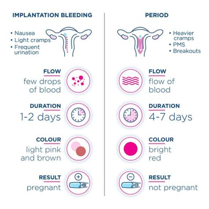 Can I get pregnant one week after Nexplanon removal?