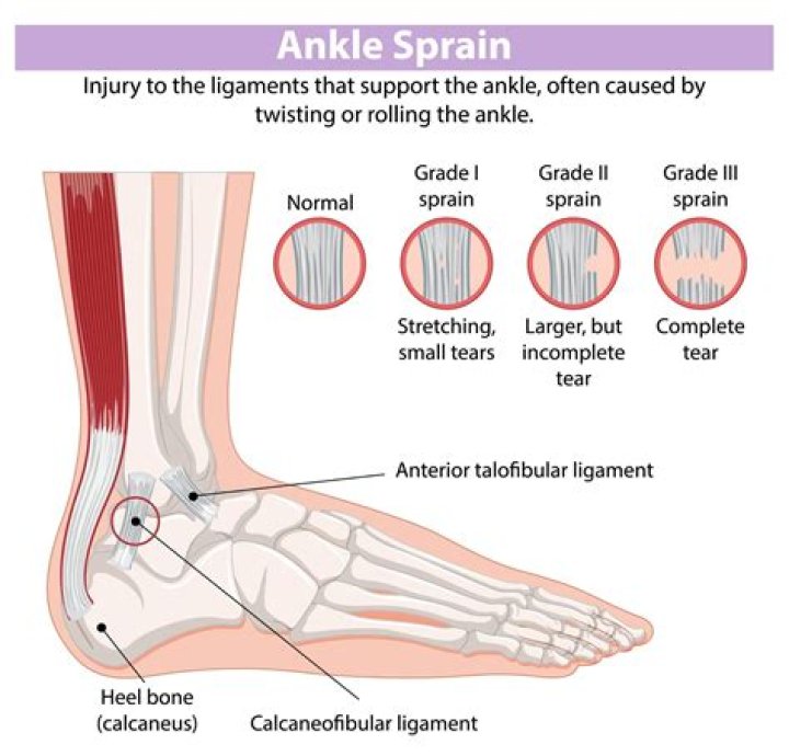 Can I massage my sprained ankle?