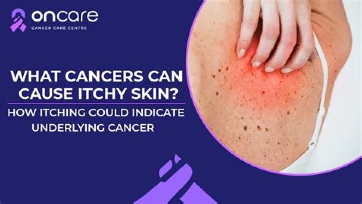 Can Sahara dust cause Itchy skin?