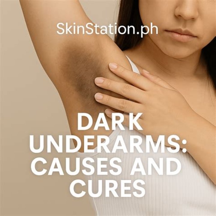 Can scratching cause dark underarms?