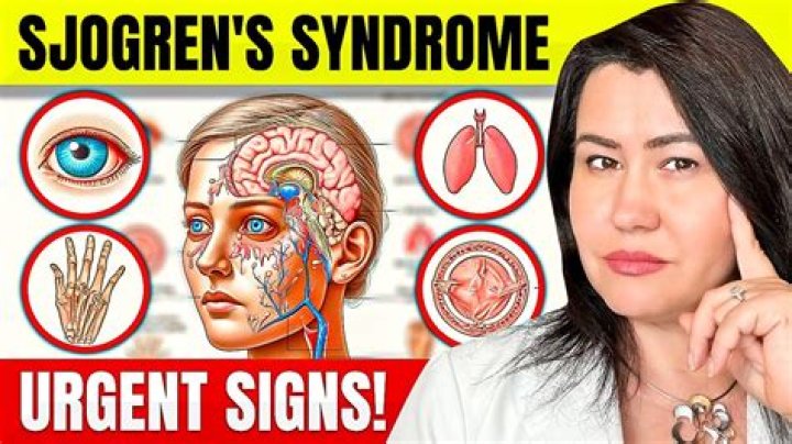 Can Sjogren's go away?