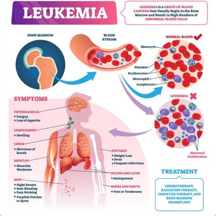 Can you fully recover from leukemia?