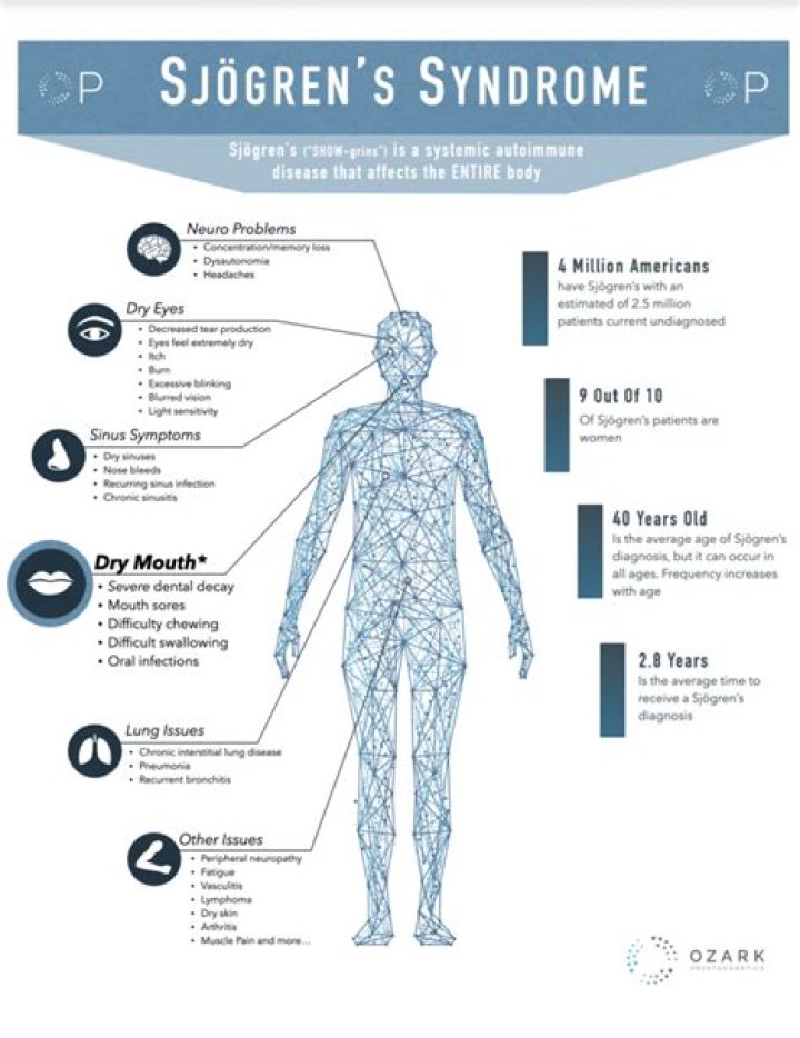 Can you reverse Sjogren's syndrome?