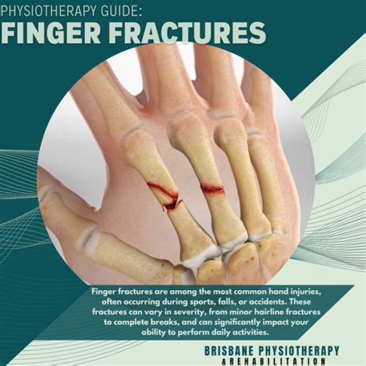 Can you still move your arm if it fractured?