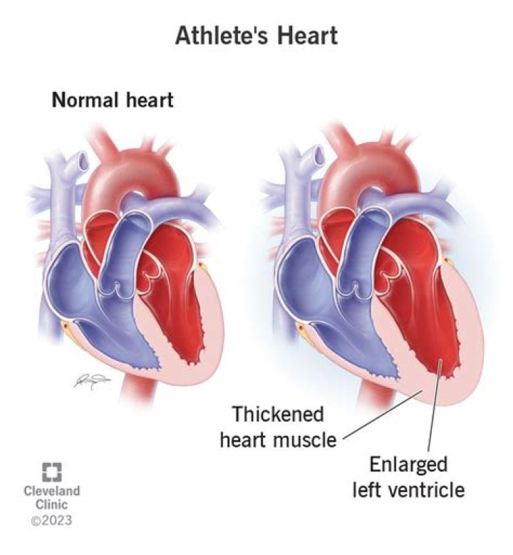 Do athletes have a bigger heart?