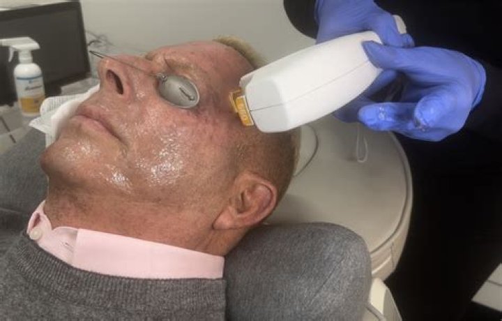 Does BBL laser tighten skin?