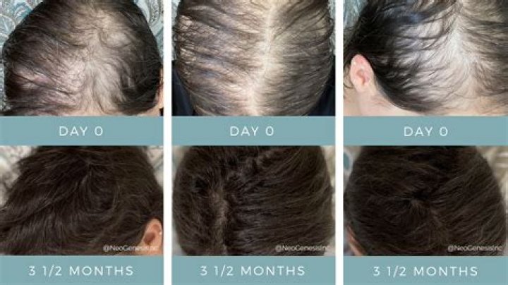 Does developer make your hair fall out?