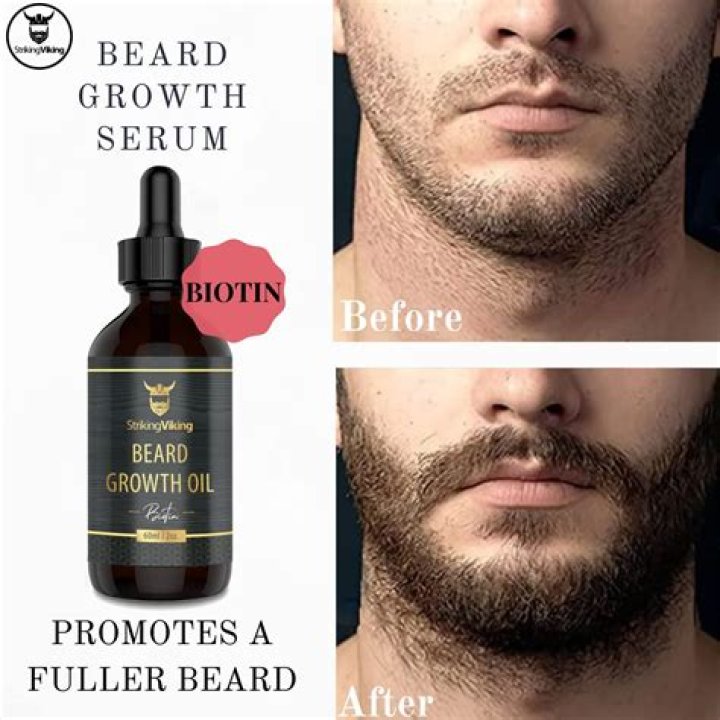 Does drinking water help grow beard?