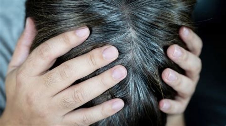 Does egg cause GREY hair?