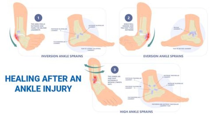 Does swelling mean its healing?