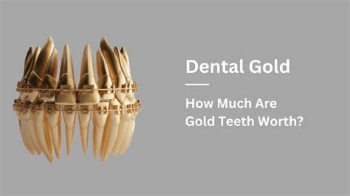 How can I tell if my gold coin is real?