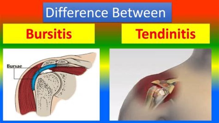 How can you tell the difference between tendonitis and bursitis?