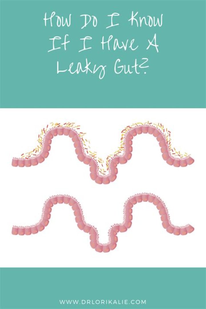How do I know if I have a leaky gut?