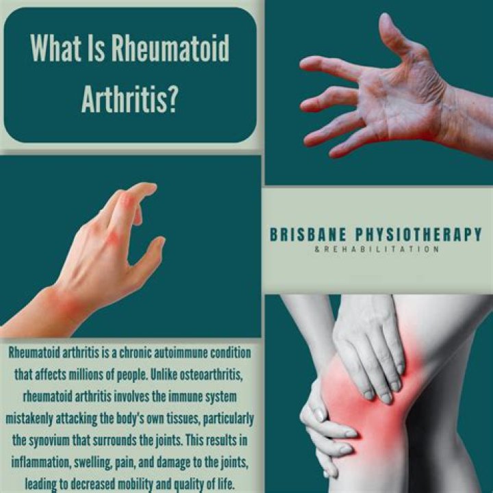 How do you know what kind of arthritis you have?