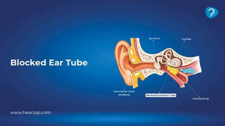 How long can a blocked ear last?