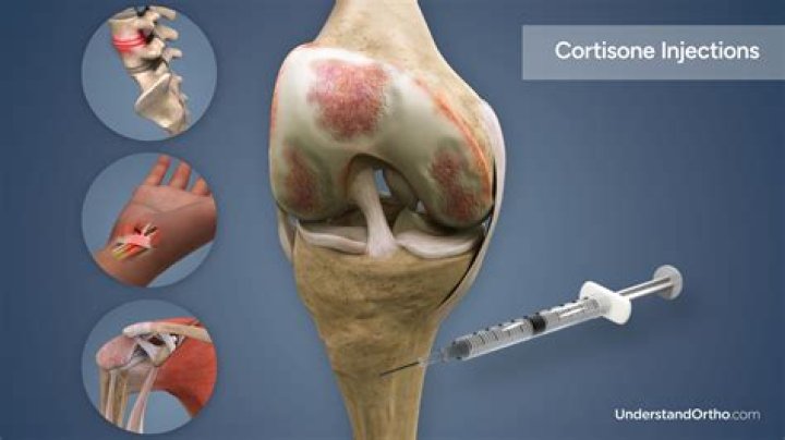 How long does it take for cortisone injection in foot to work?