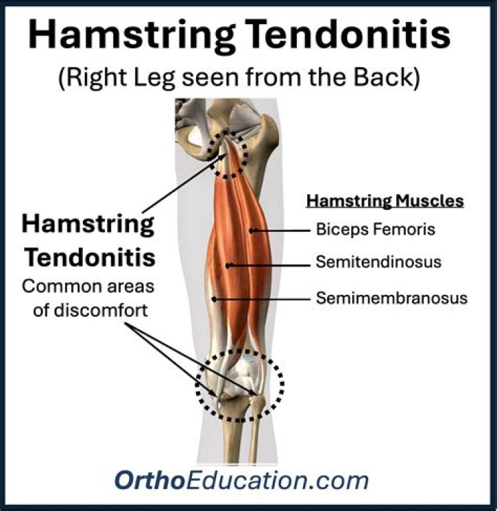 How long does it take to recover from high hamstring tendinopathy?