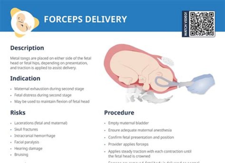 How many babies are dropped during delivery?
