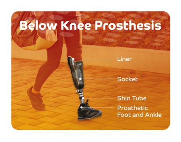 How much does a broken leg cost UK?