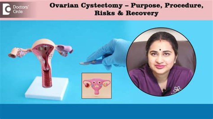 Is it safe to have a cyst removed?