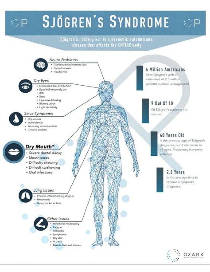 Is Sjogren's syndrome curable?