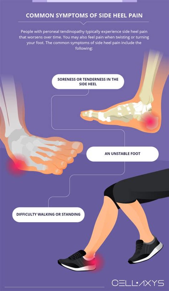 Is toe side or heel side easier?