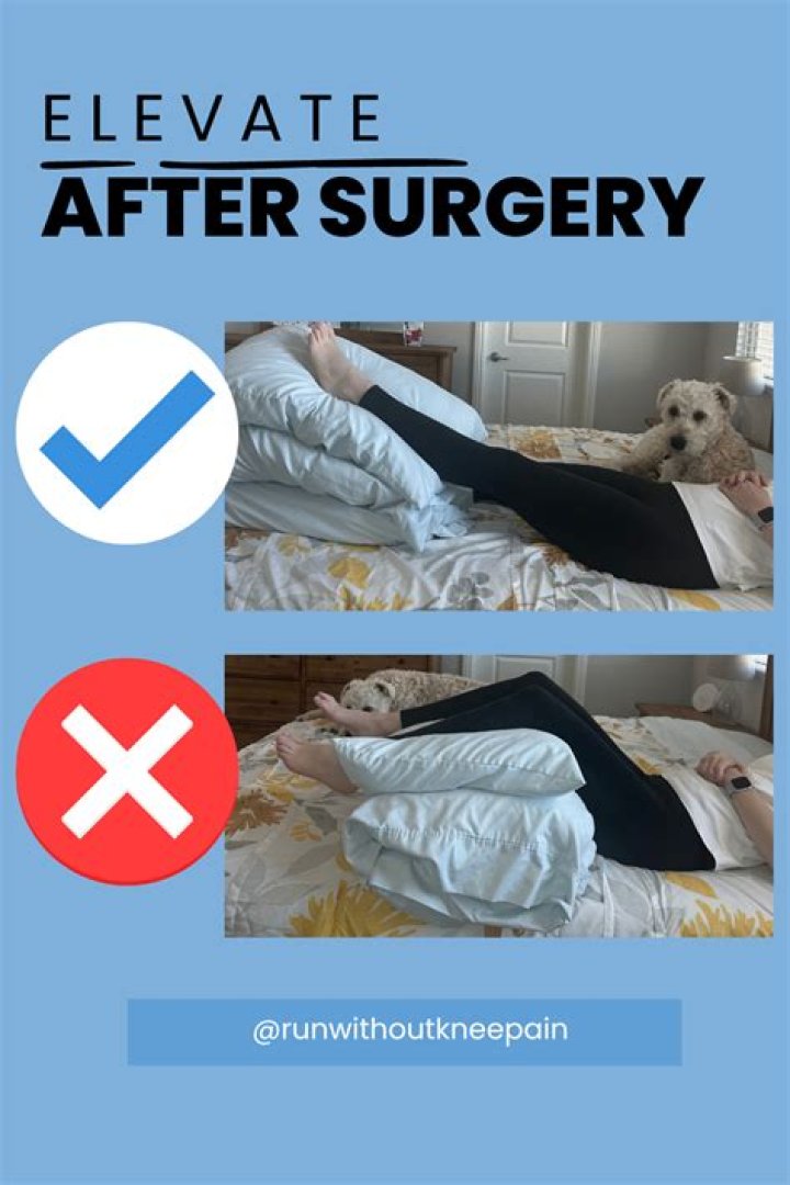 Should I elevate my knee overnight?