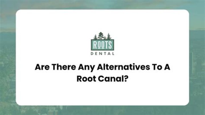 What's the alternative to a root canal?