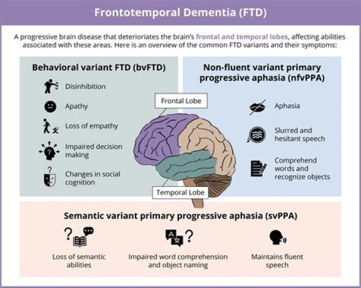 What are some of the first symptoms noticed in frontal lobe dementia?