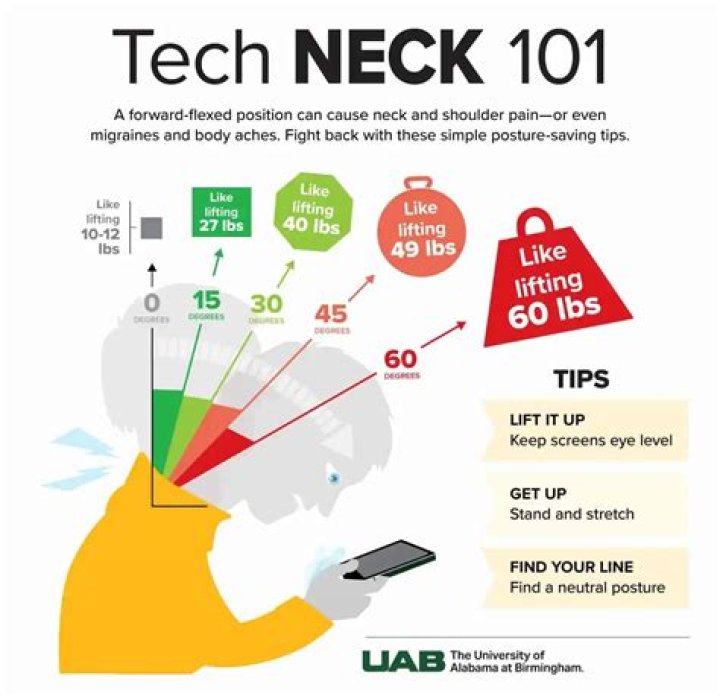 What are the symptoms of tech neck?