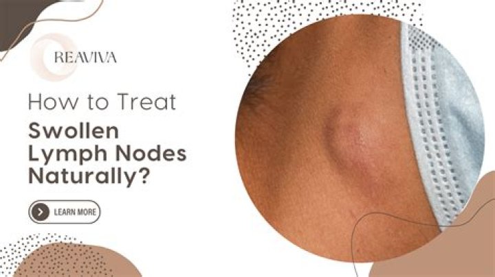What can I rub on swollen lymph nodes?
