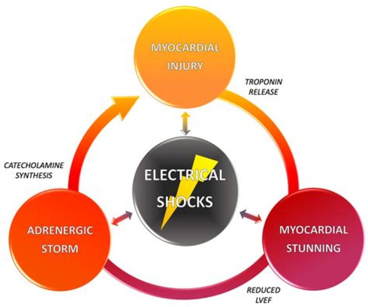 What causes defibrillator shocks?