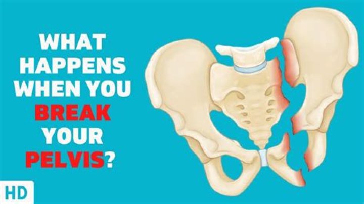 What does a bruised pelvis feel like?
