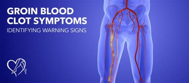 What does a tear in the groin feel like?