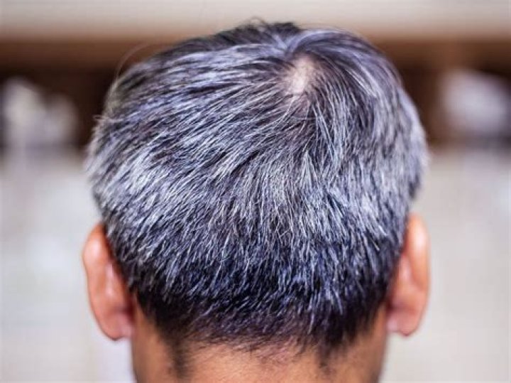 What does it mean when your hair turns black?