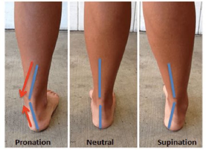 What does supination mean in medical terms?