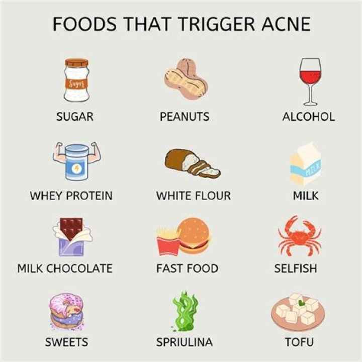 What foods cause pimples?