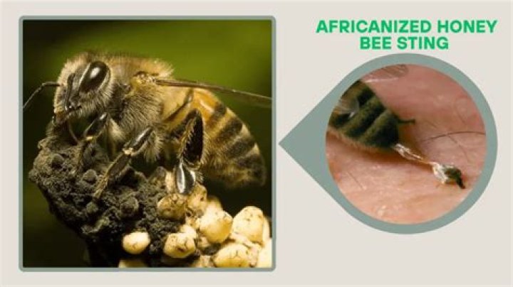 What happens if a honey bee stings you?