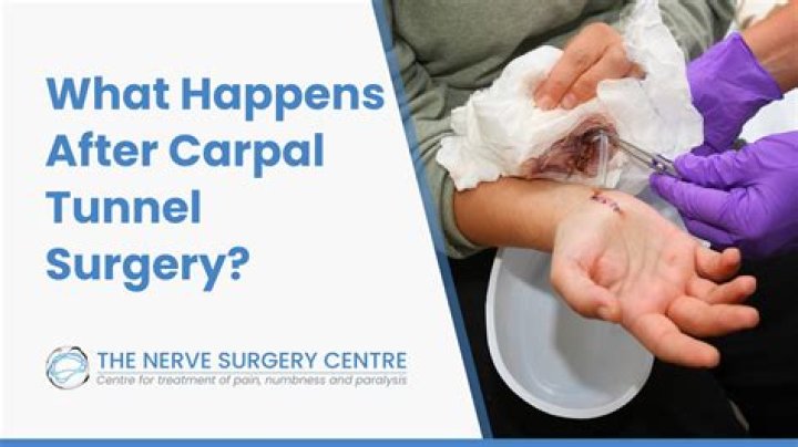 What happens if carpal tunnel surgery doesn't work?