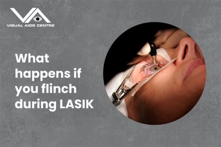What if you sneeze during LASIK?