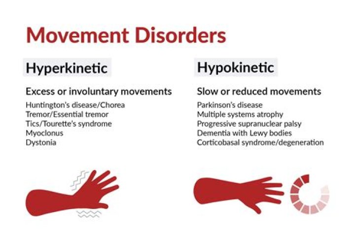 What is Hypokinetic pulse?