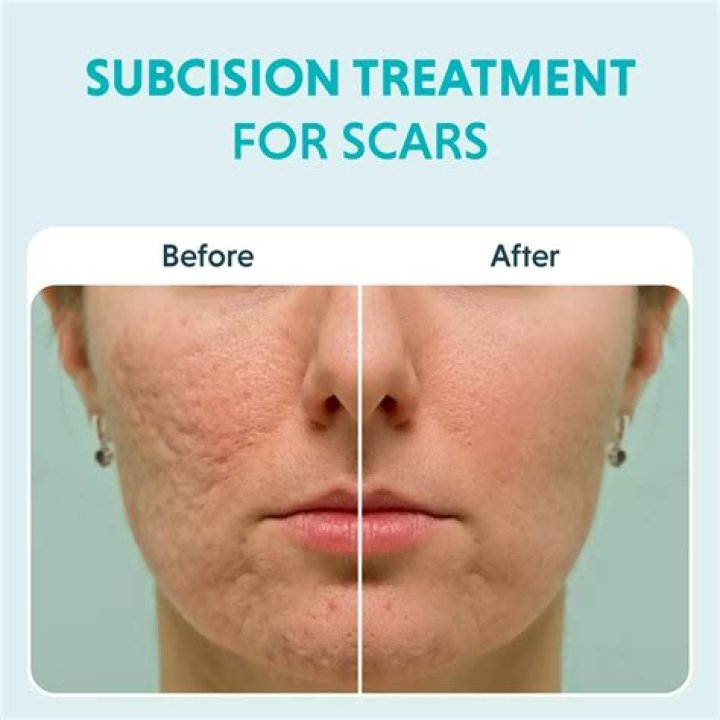 What is the best thing to reduce scars?