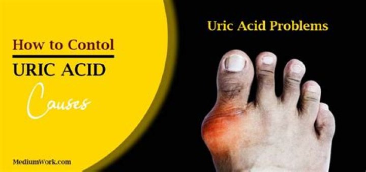 What is the fastest way to cure uric acid?