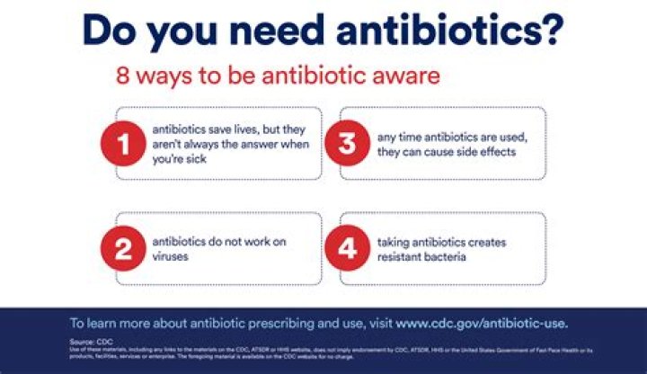 When do you need antibiotics for abscess?