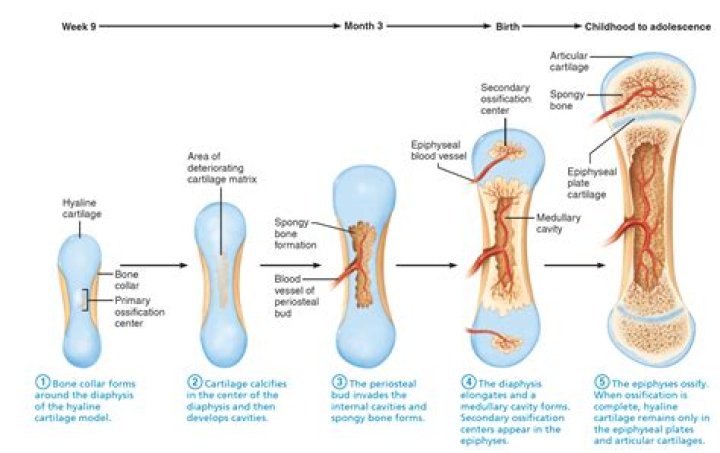 Which bone-forming process is shown in the figure?